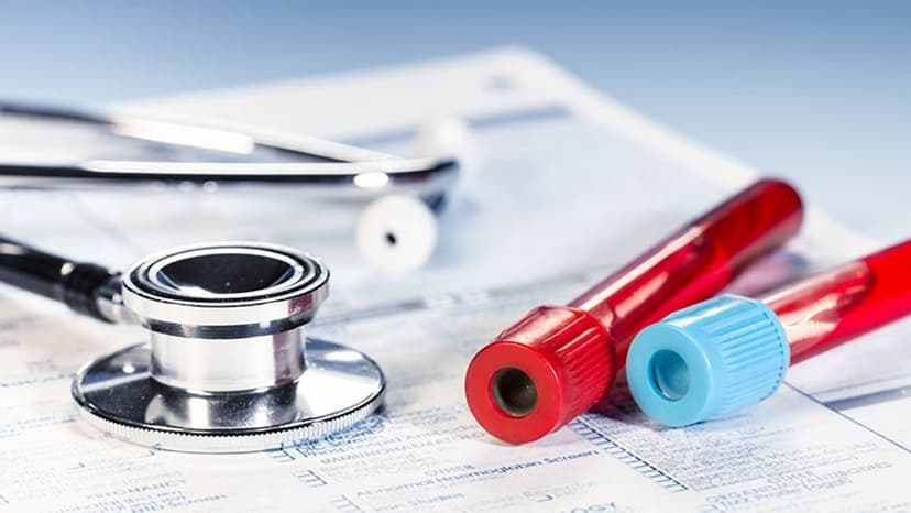 2 lưu ý quan trọng cần biết khi làm xét nghiệm ung thư sớm