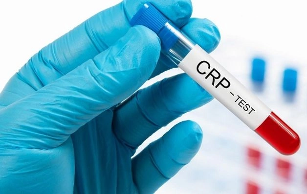 xét nghiệm sốt virus ở người lớn