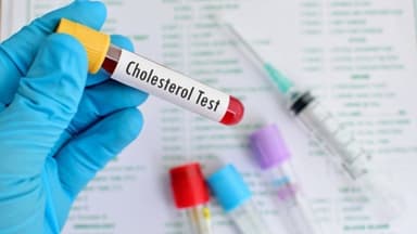 Giải đáp các thắc mắc thường gặp về xét nghiệm mỡ máu