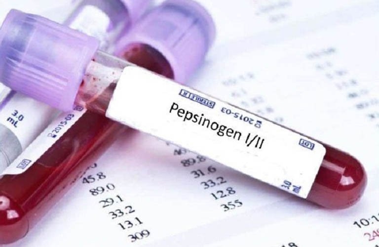Xét nghiệm phát hiện ung thư tiêu hóa gồm những gì?