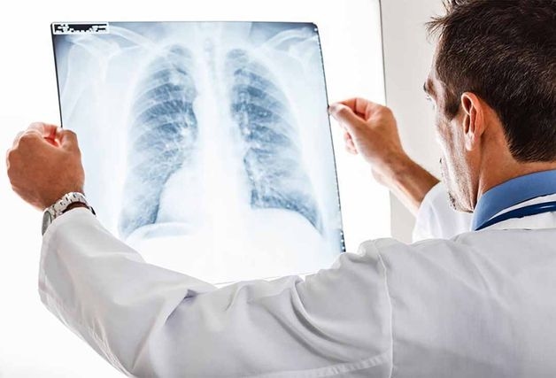 điều trị ho khan kéo dài
