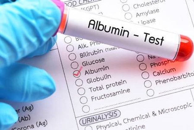 chi phí xét nghiệm chức năng gan