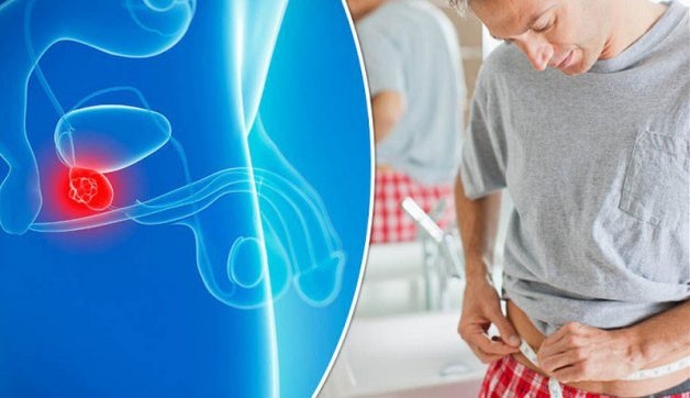 Tìm hiểu bản chất của chất chỉ điểm