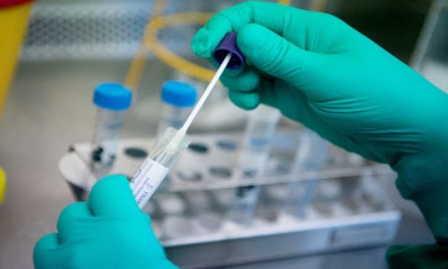 chi phí xét nghiệm pcr