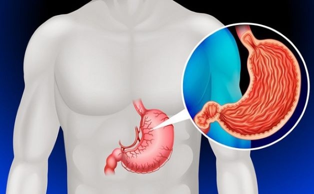 Xét nghiệm sinh thiết dạ dày