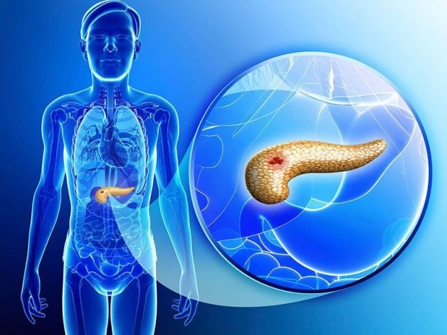 Xét nghiệm ung thư tụy có chính xác không?