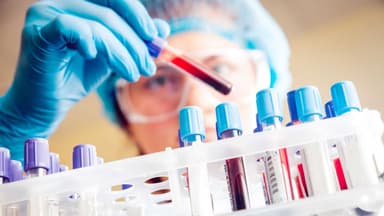 3 điều cần biết về phương pháp xét nghiệm PCT