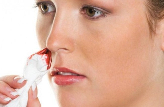 Viêm xoang cánh bướm là bệnh không đơn giản