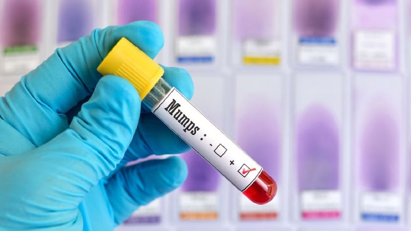 Hiểu đúng về kết quả xét nghiệm âm tính và dương tính