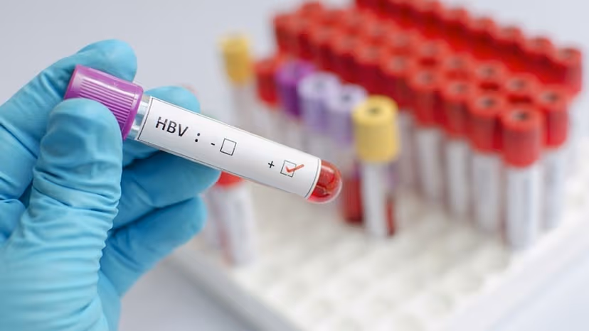 Tìm hiểu về xét nghiệm định lượng HBsAg