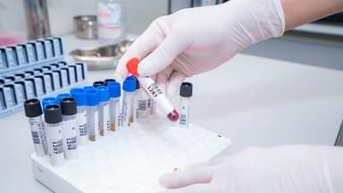 Tìm hiểu ý nghĩa của phương pháp xét nghiệm đông máu