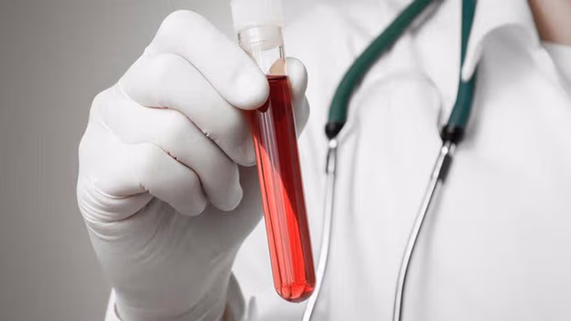 Xét nghiệm đường máu và những thông tin cần biết