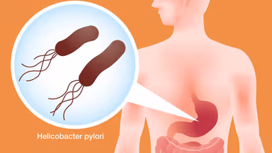 Xét nghiệm H.pylori là gì và những vấn đề liên quan