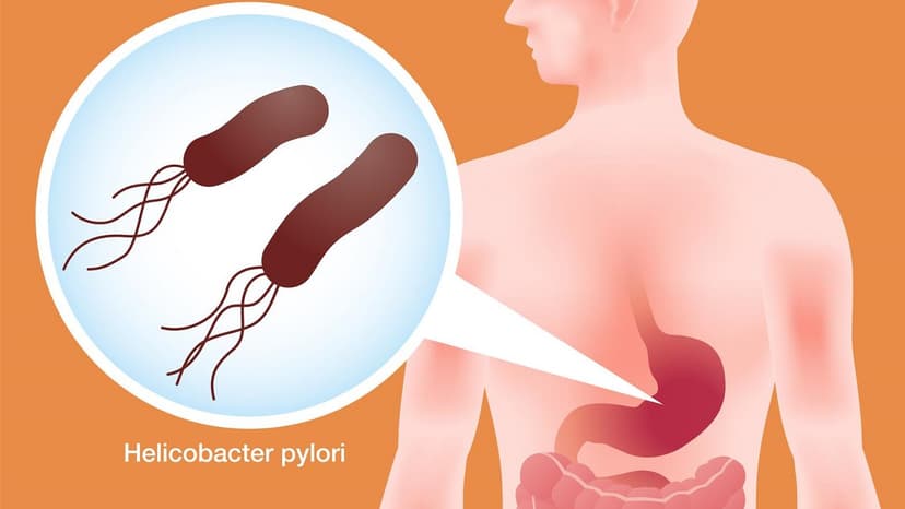 Xét nghiệm H.pylori là gì và những vấn đề liên quan