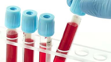 Xét nghiệm H.pylori và những điều cần nắm rõ