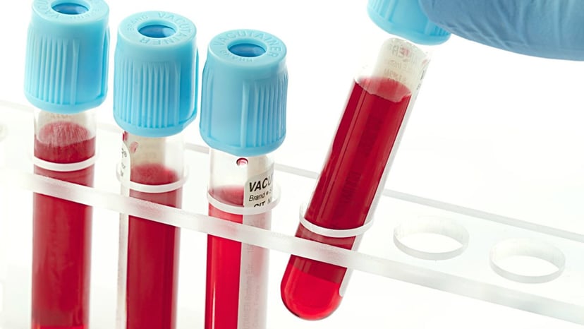 Xét nghiệm HP huyết thanh và những điều cần biết