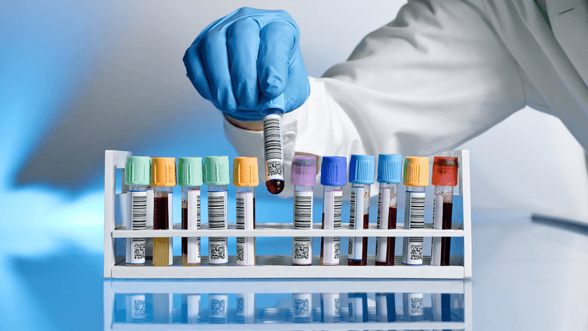 Xét nghiệm suy thận và những điều có thể bạn chưa biết