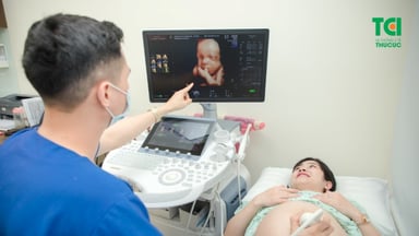 Siêu âm 32 tuần: Dấu mốc quan trọng cuối thai kì