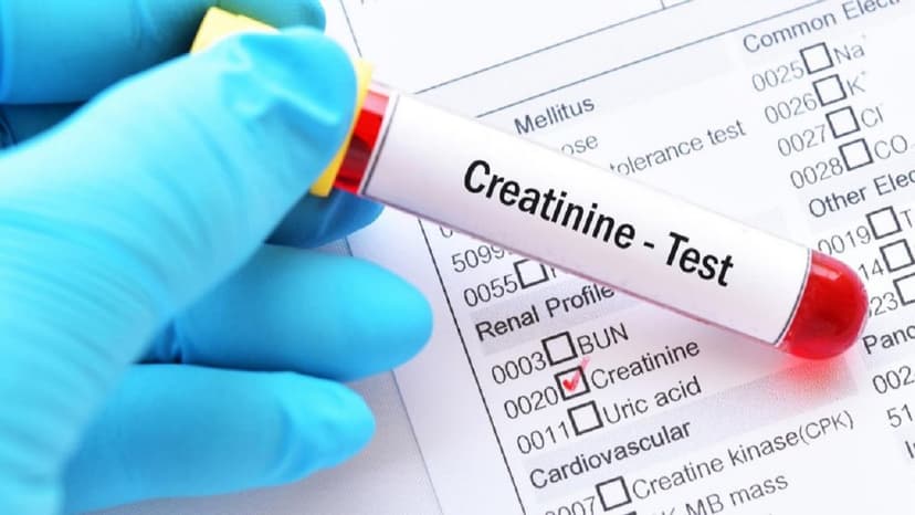 Các chỉ số xét nghiệm máu và ý nghĩa trong chẩn đoán