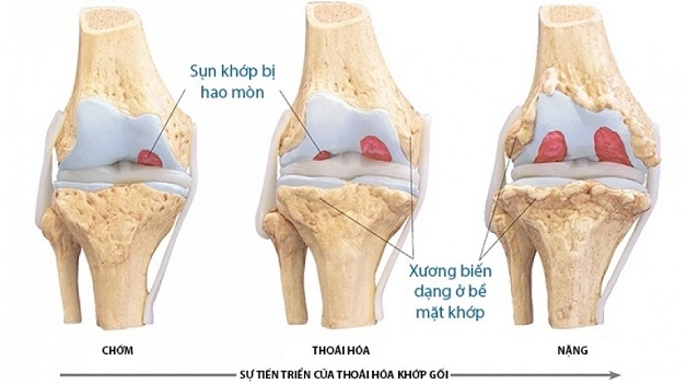 chi phí chụp mri khớp gối ở đâu rẻ