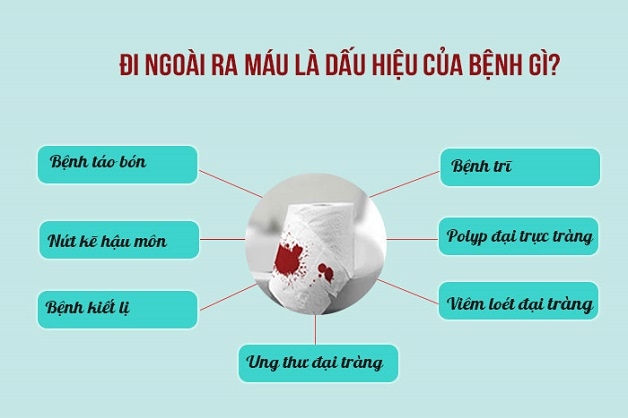 máu trong phân dấu hiệu nhận biết ung thư đại tràng
