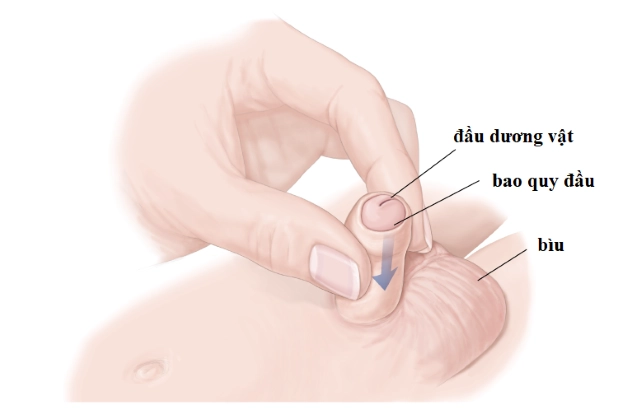 Tùy vào tình trạng bệnh của trẻ, từ đó bác sĩ sẽ đưa ra phác đồ điều trị hiệu quả và an toàn.