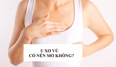 U xơ vú có nên mổ không và mổ bằng phương pháp nào?
