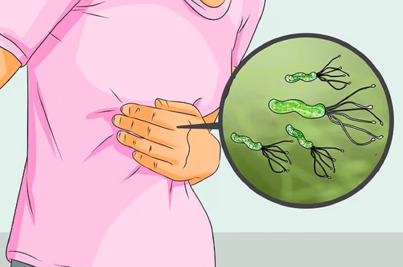 Vi khuẩn H pylori là gì: con đường lây nhiễm và phòng bệnh