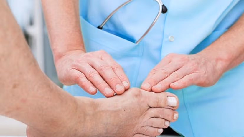 Viêm khớp ngón chân và 5 dấu hiệu nhận biết của bệnh