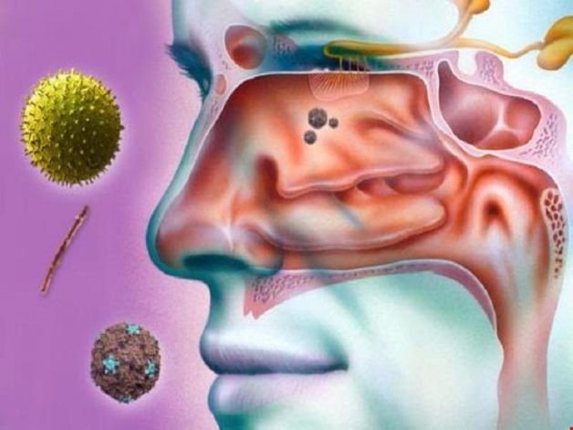 Các loại nấm và vi khuẩn này xâm nhập và phát triển trong các xoang, làm tổn thương tế bào lông chuyển ở niêm mạc xoang