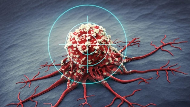 Điều trị ung thư dạ dày giai đoạn cuối bằng thuốc đích