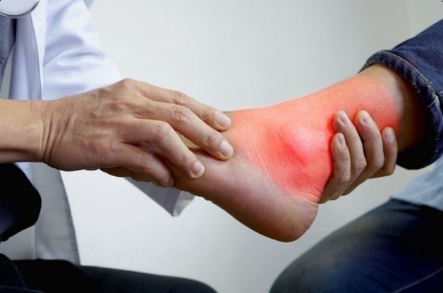 hình ảnh sưng mắt cá chân