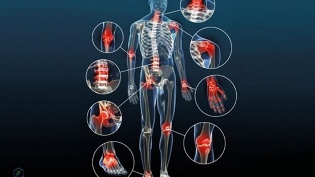 “Nhận diện” mối nguy khớp bị thoái hóa