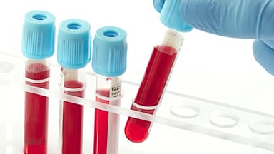 Xét nghiệm ung thư dạ dày và những điều cần biết