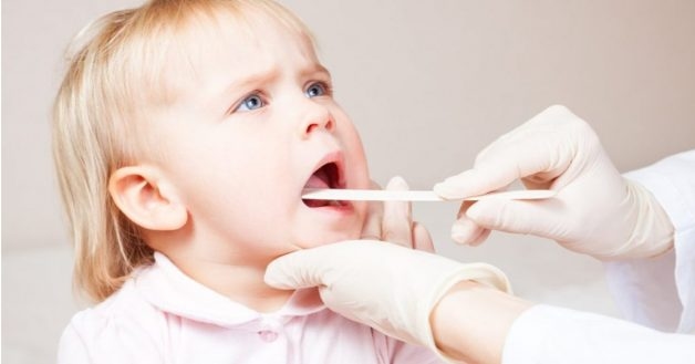 Lưu ý trước khi cắt amidan