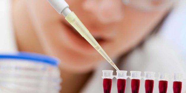 bệnh loạn dưỡng cơ tiến triển có nguy hiểm không