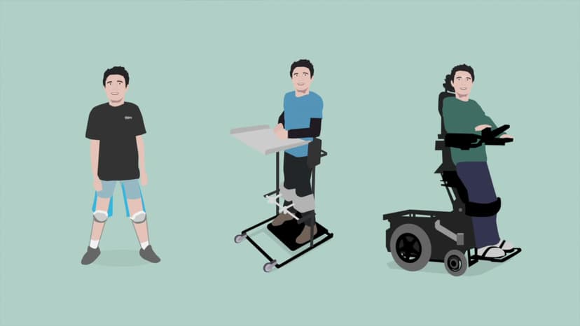 Chẩn đoán và điều trị bệnh loạn dưỡng cơ tiến triển