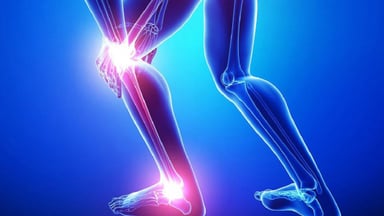 Chữa thoái hóa khớp gối đúng cách như thế nào?