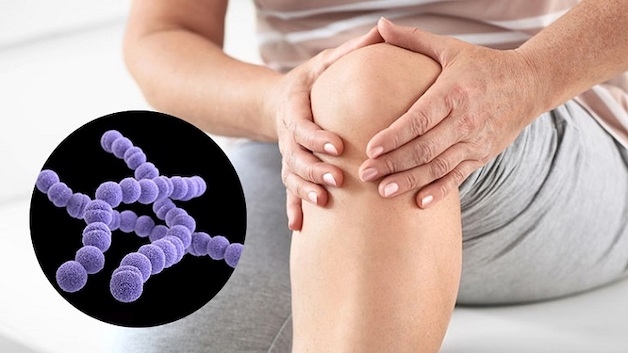 viêm khớp liên cầu là gì