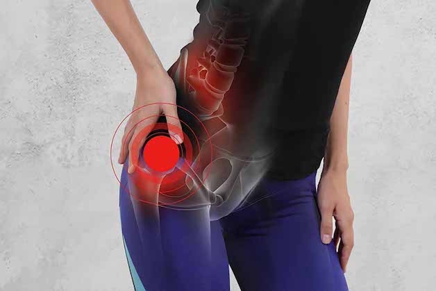 tìm hiểu về mổ thay xương khớp háng