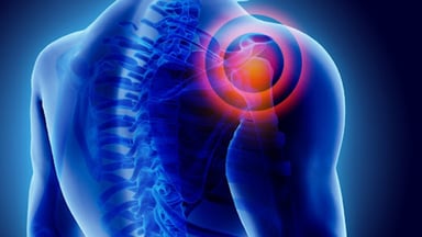 Tìm hiểu về bệnh viêm khớp vai và cách điều trị