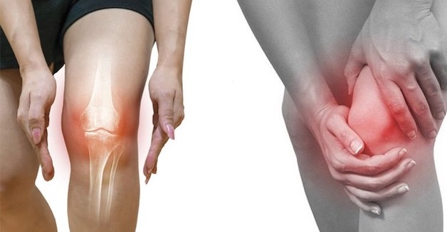 Viêm khớp cấp là bệnh gì