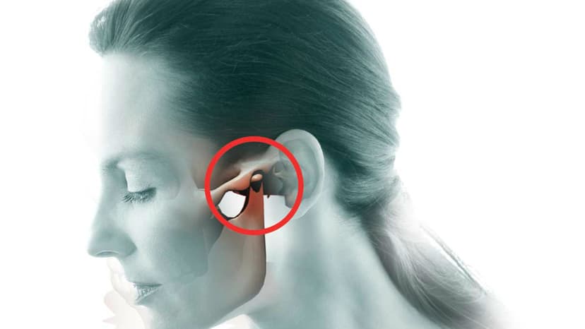 Viêm khớp thái dương hàm nổi hạch nguy hiểm ra sao?