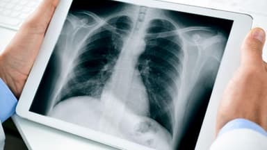 Sự nguy hiểm của việc chụp X quang khi mang thai 4 tuần