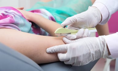 Cấy que tránh thai ở đâu Hà Nội uy tín, chất lượng?