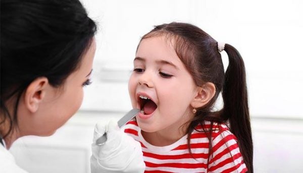 viêm amidan ở trẻ