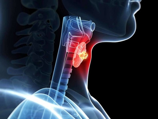 Ung thư tuyến giáp thể nhú tiên lượng tốt