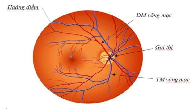 Khi soi đáy mắt của người bệnh bị huyết áp ngoài các dấu hiệu của giai đoạn 3 thì người bệnh sẽ có thêm phù gai thị.