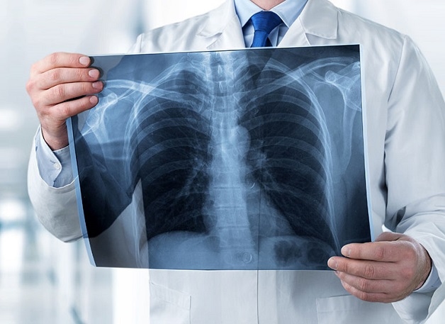 Chụp X quang ngoài giờ có tốt không?