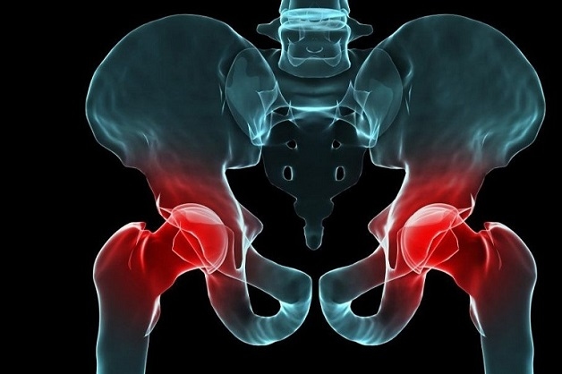 Chụp MRI khớp háng có tốt không?